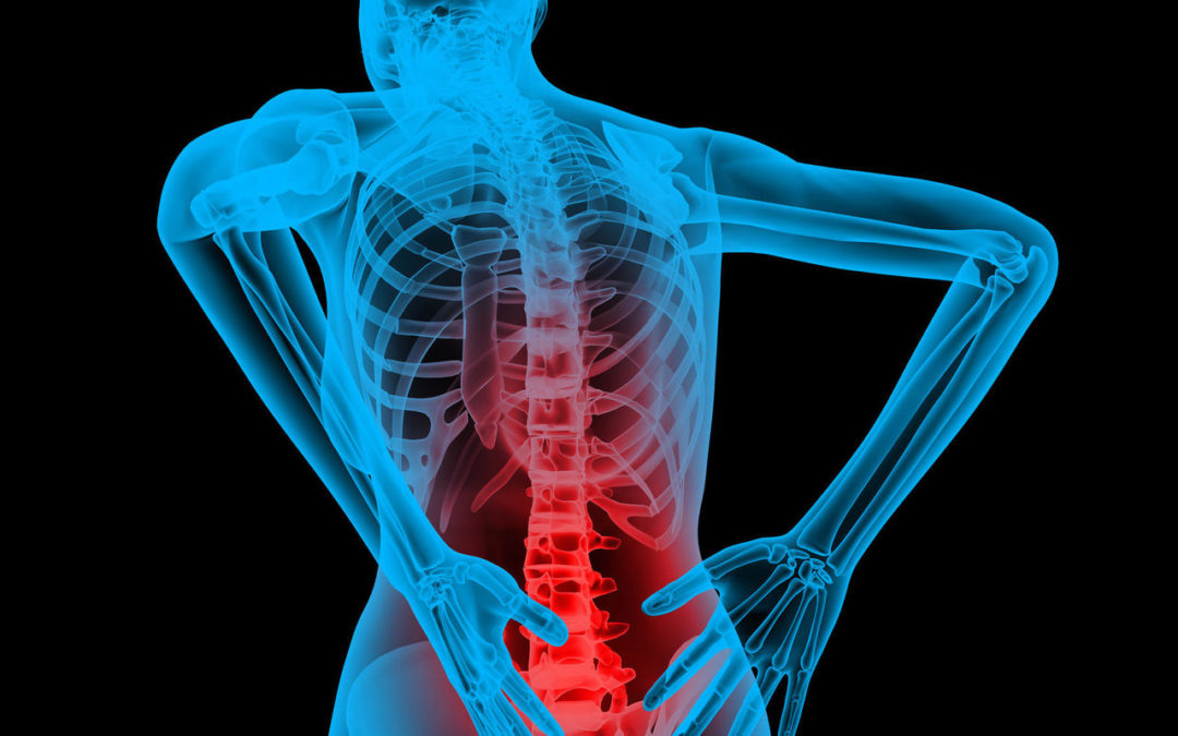 The top 5 ways to deal with Acute Back Pain